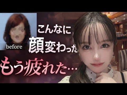 5000万課金YouTuber、整形に終止符?「もうやめたい…」衝撃告白の裏側
